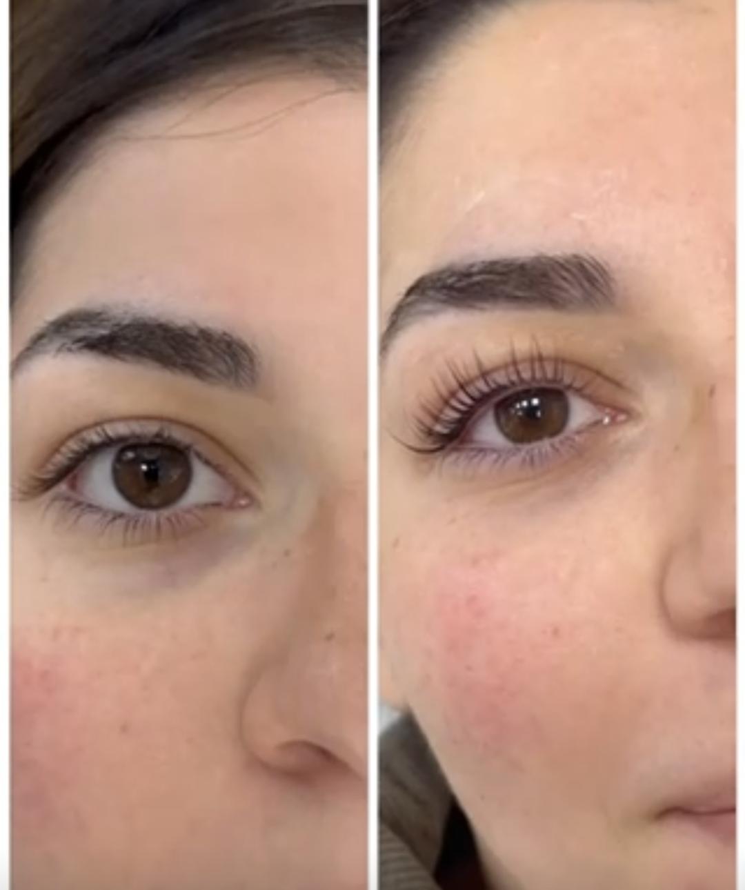 Lash i Brow lift + botox + farbanje - Magic Touch room, Beograd Trepavice Lice Trepavice, Beograd, Voždovac