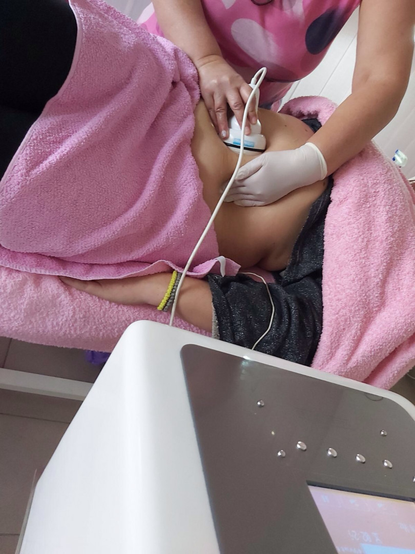 AngeLine #novisad Kavitacija Kavitacija - jedna regija