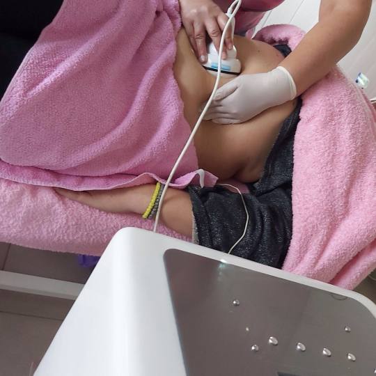 AngeLine #novisad Kavitacija Kavitacija - jedna regija Topljenje masnih naslaga