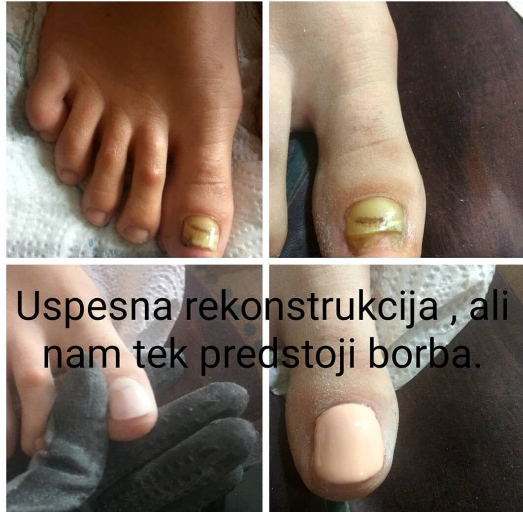 Nail Studio MPN #beograd Estetski pedikir