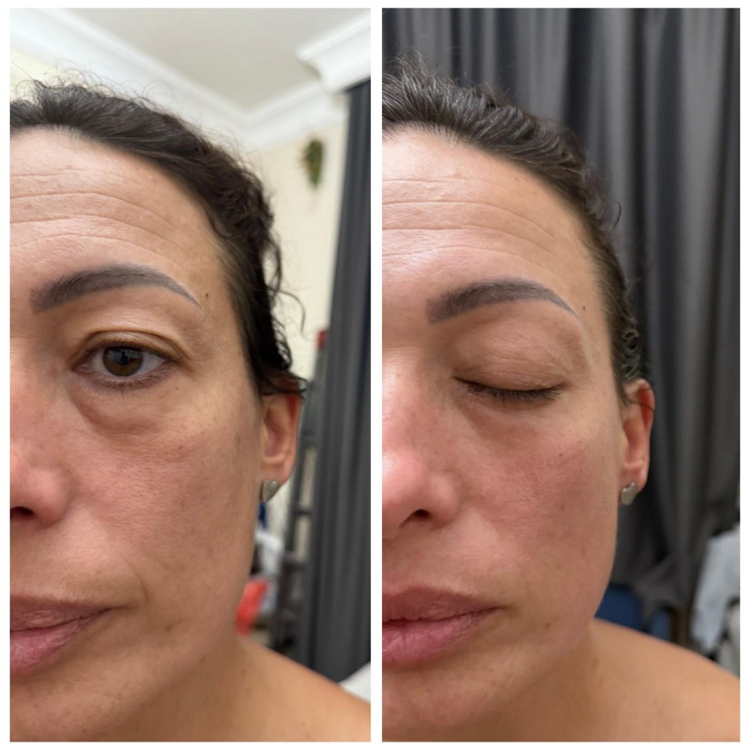 Fitt limfno modelovanje lica ,vrata i dekoltea - Leonis Beauty Premium, Beograd Tretmani vrata i dekoltea Lice Tretmani vrata i dekoltea, Beograd, Novi Beograd blokovi, Belville, Savski kej