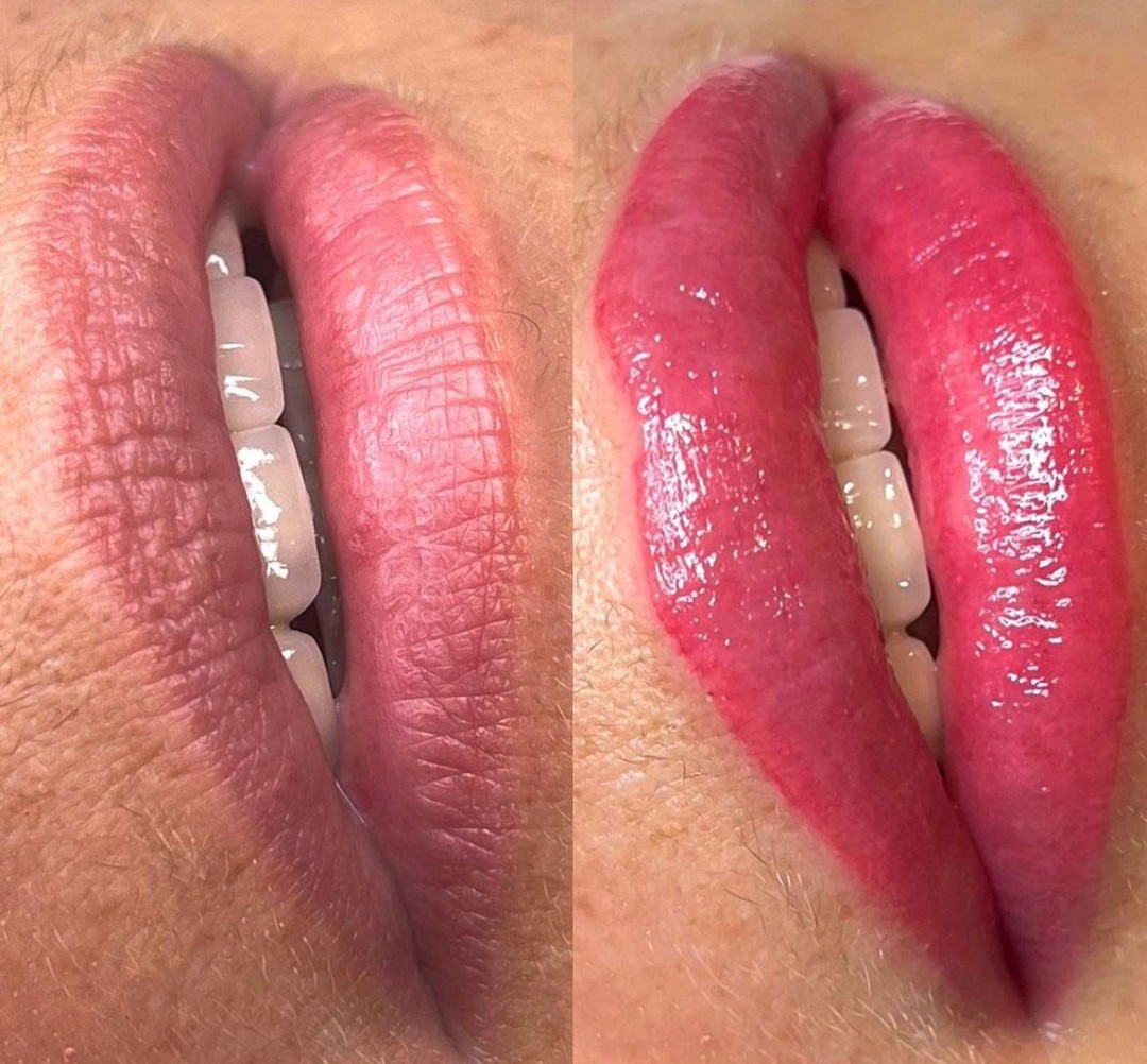 Esthetique Privé #beograd Trajna šminka Trajna šminka usana - PHILIPPS