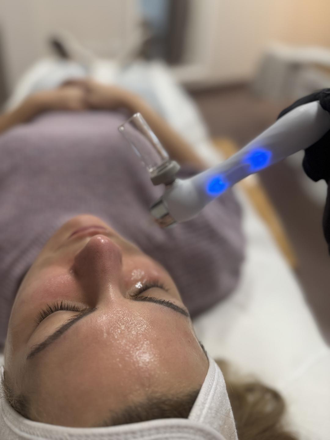 L’Avenue #beograd Tretman lica OXY JET tretman kiseonikom