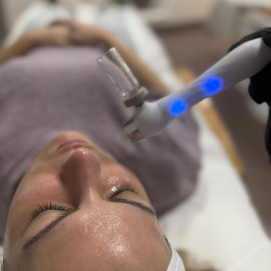 L’Avenue #beograd Tretman lica OXY JET tretman kiseonikom