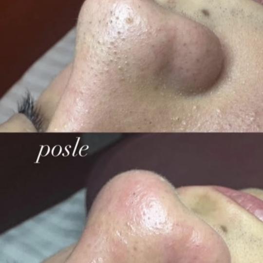 Beautique spa usluga