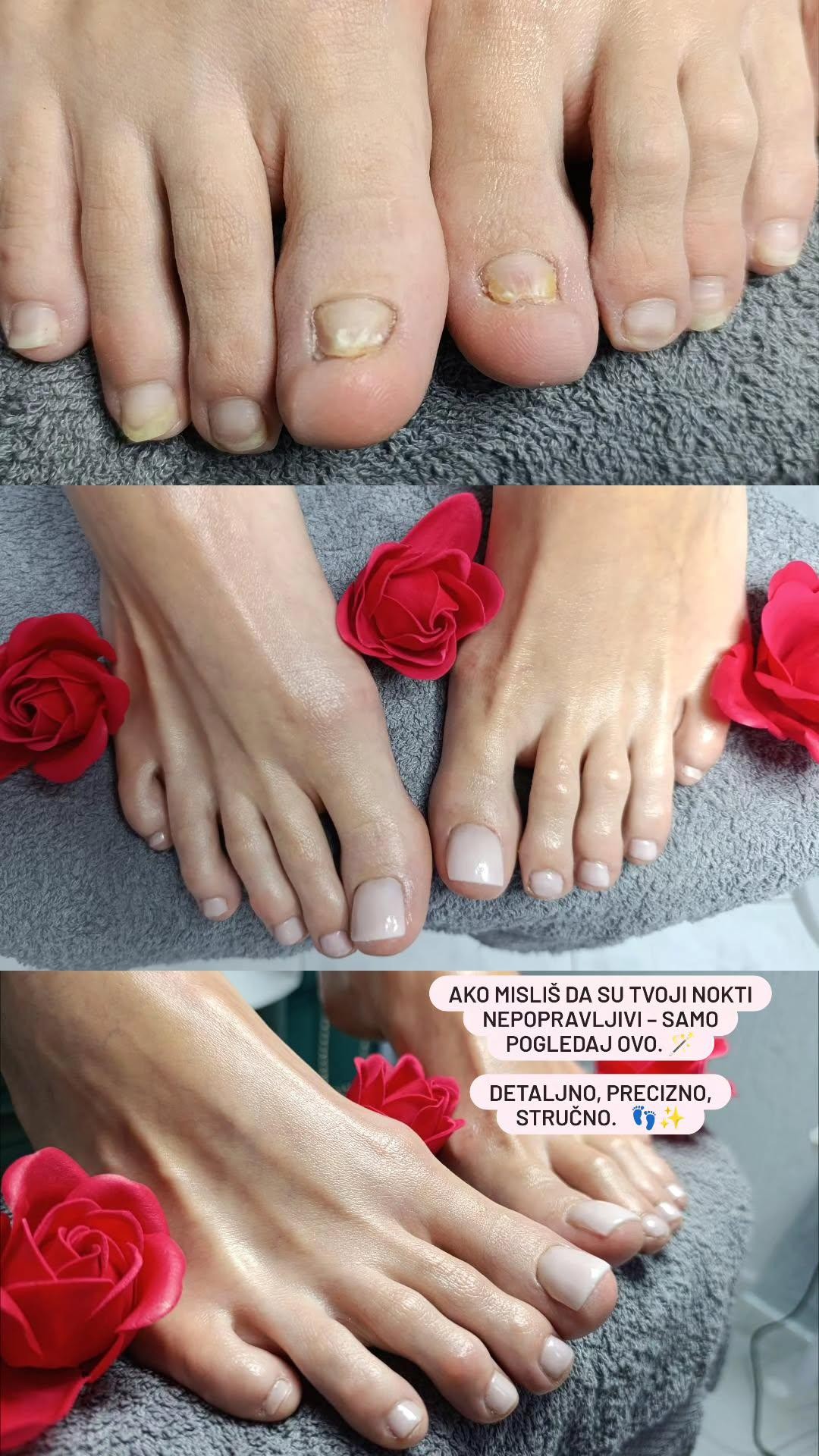Hellena Cosmetics #novisad Medicinski pedikir Medicinski pedikir + gel lak - Zdravlje i stil