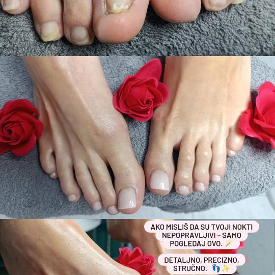 Hellena Cosmetics #novisad Medicinski pedikir Medicinski pedikir + gel lak - Zdravlje i stil