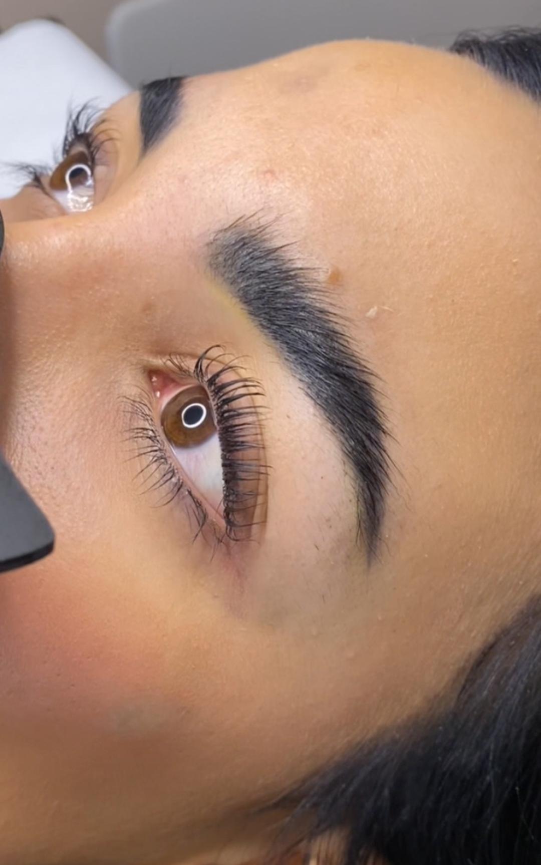 Brow lift - Gold Club, Beograd Obrve Lice Obrve, Beograd, Banovo brdo