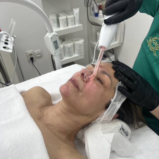 GM Beauty studio #beograd Tretman lica Higijenski tretman lica + ampula U ovom tretmanu smo radili c