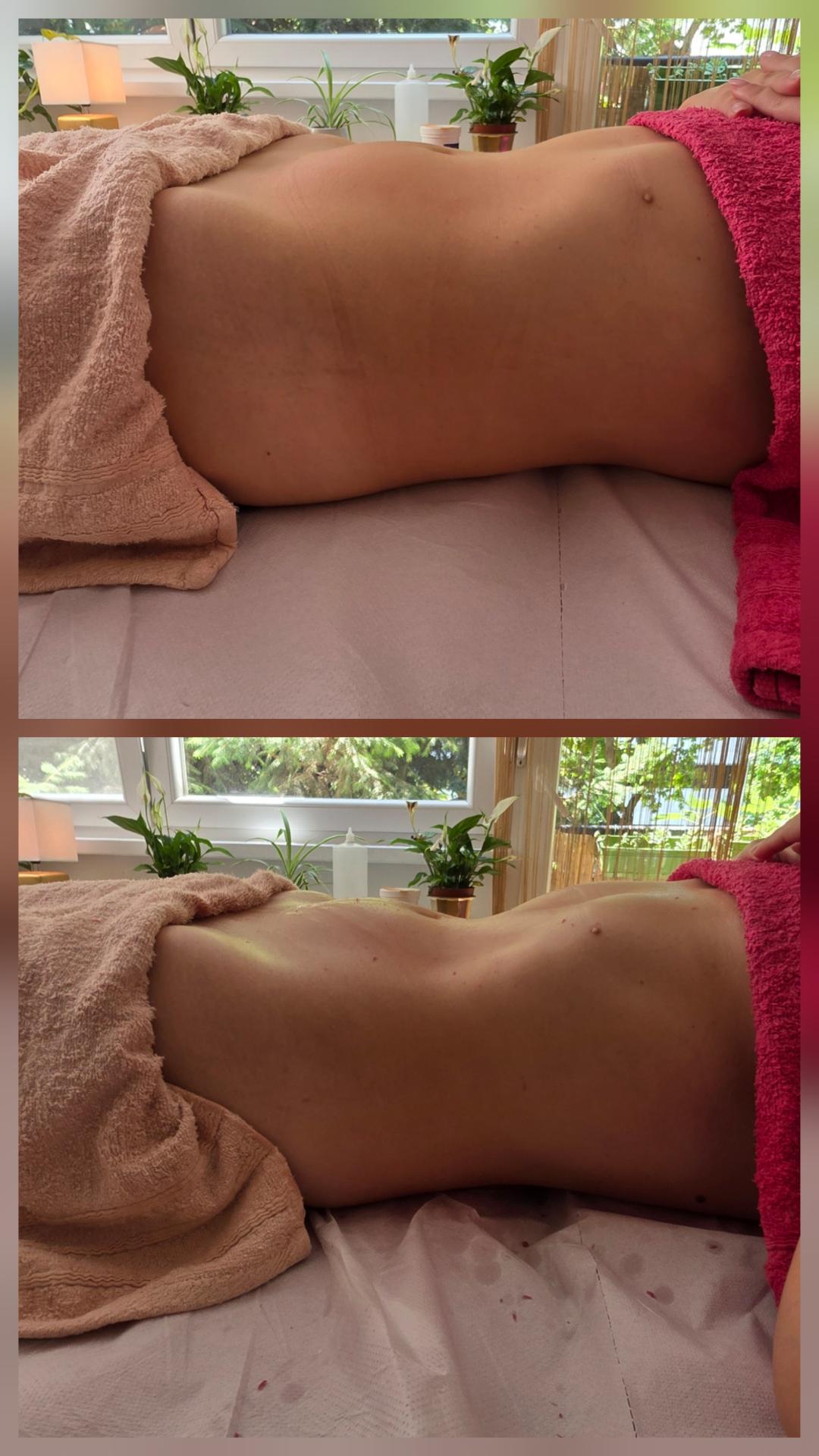 Limfna drenaža metod Manuele Shale - stomak - Wellness Concept, Beograd Tretmani tela Telo Tretmani tela, Beograd, Zemun Centar