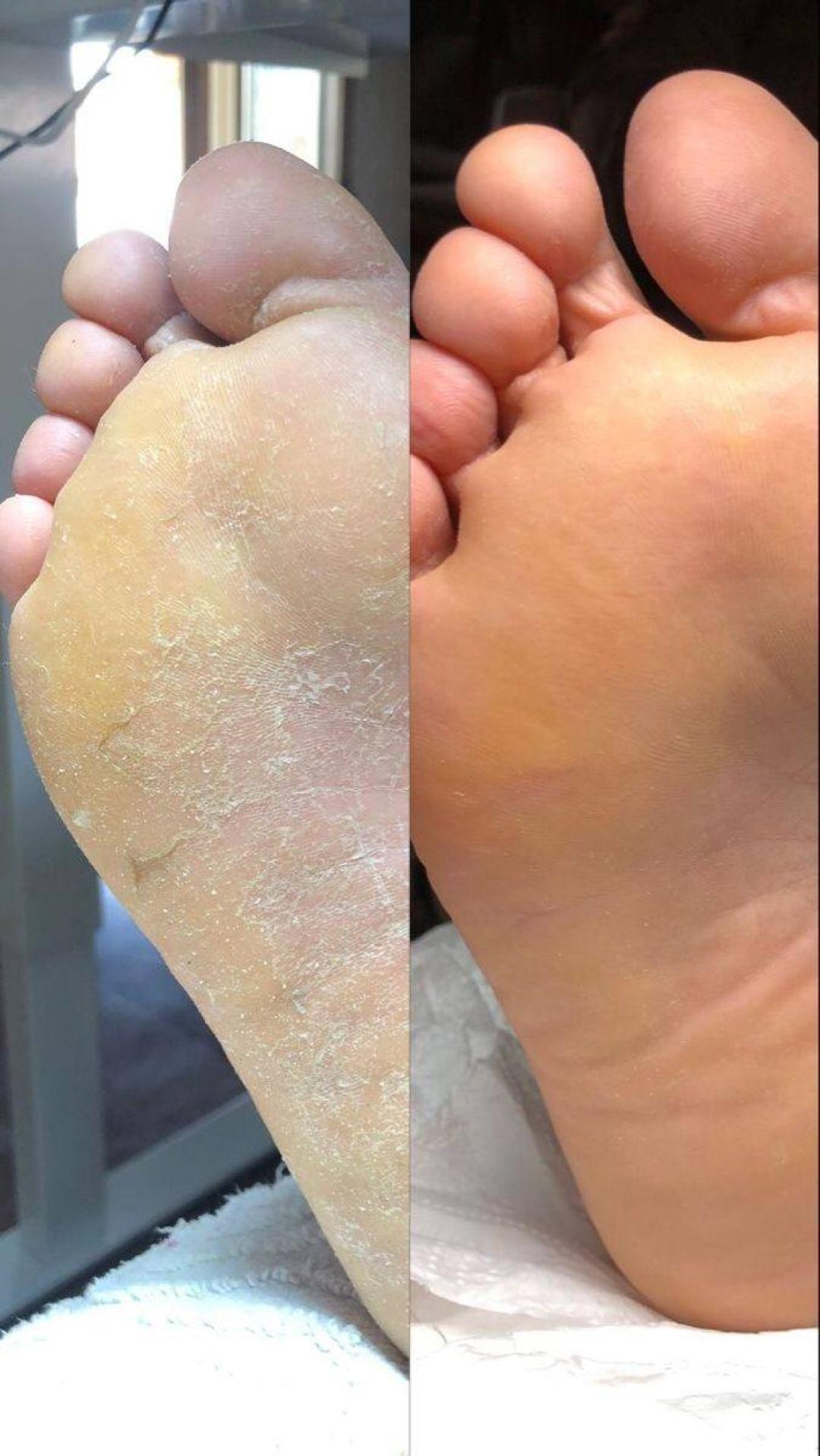 Medicinski pedikir - manje problematičan - Princess beauty, Niš Medicinski pedikir Nokti Medicinski pedikir, Niš, Palilula