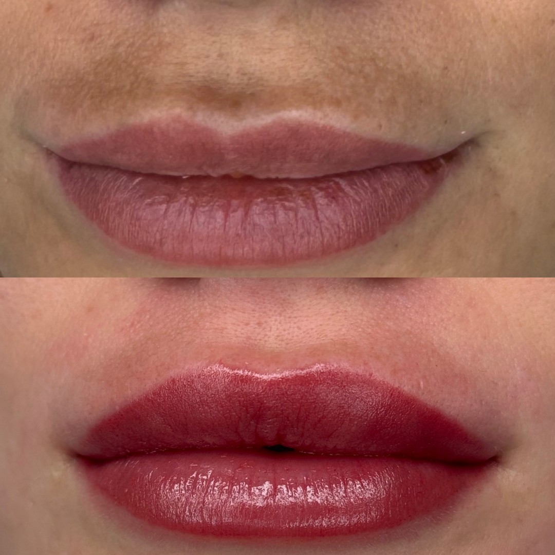 Brow & Glow #novisad Tretman lica Dermapen lica