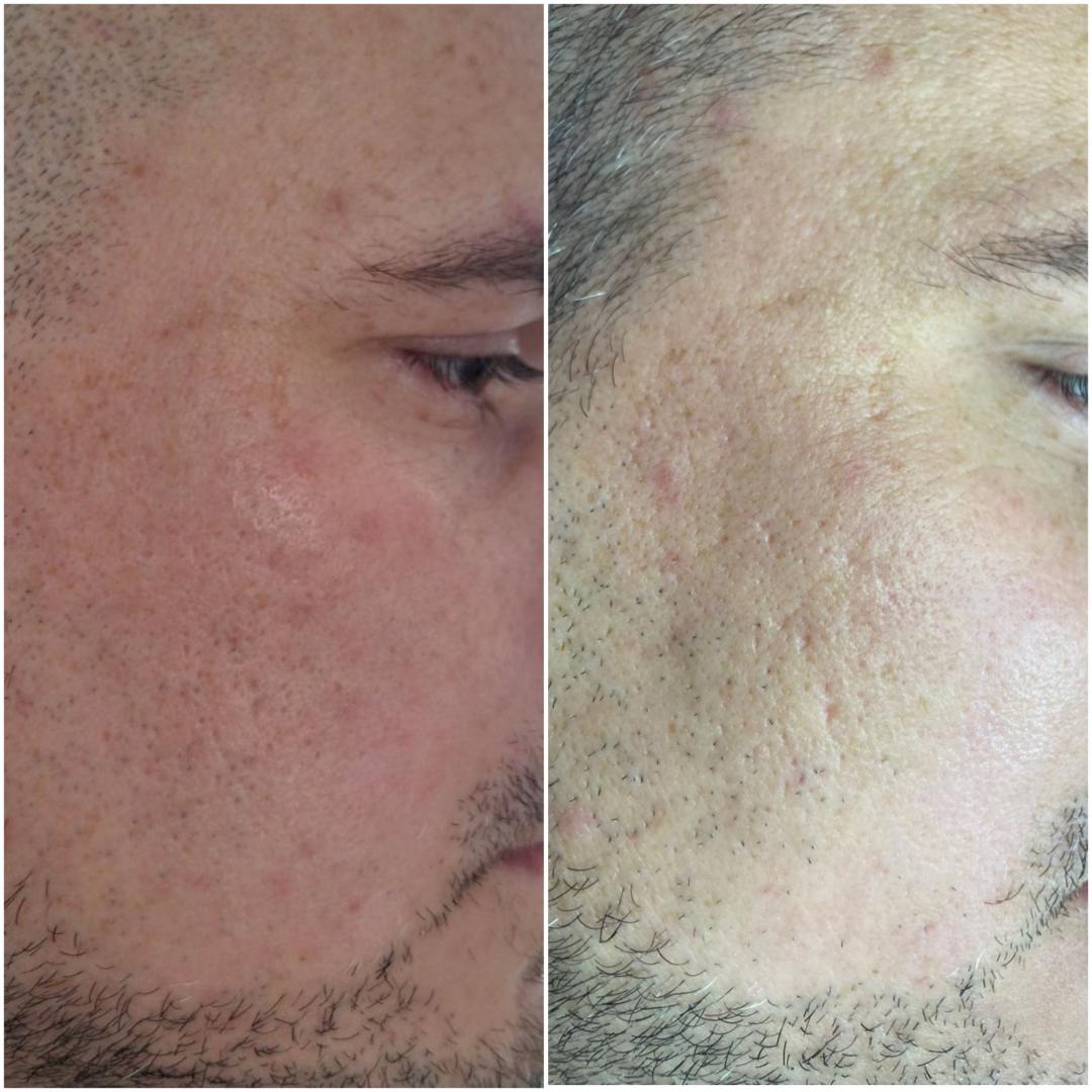 Pro lift - Look at me, Beograd Tretman lica Lice Tretman lica, Beograd, Vračar, Čubura, Crveni krst