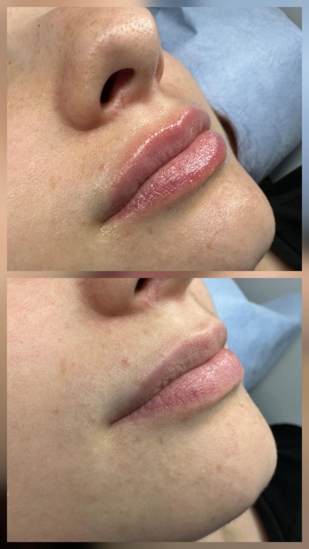 Hydra lips - Princess beauty, Niš Make-up / šminkanje Lice Make-up / šminkanje, Niš, Palilula
