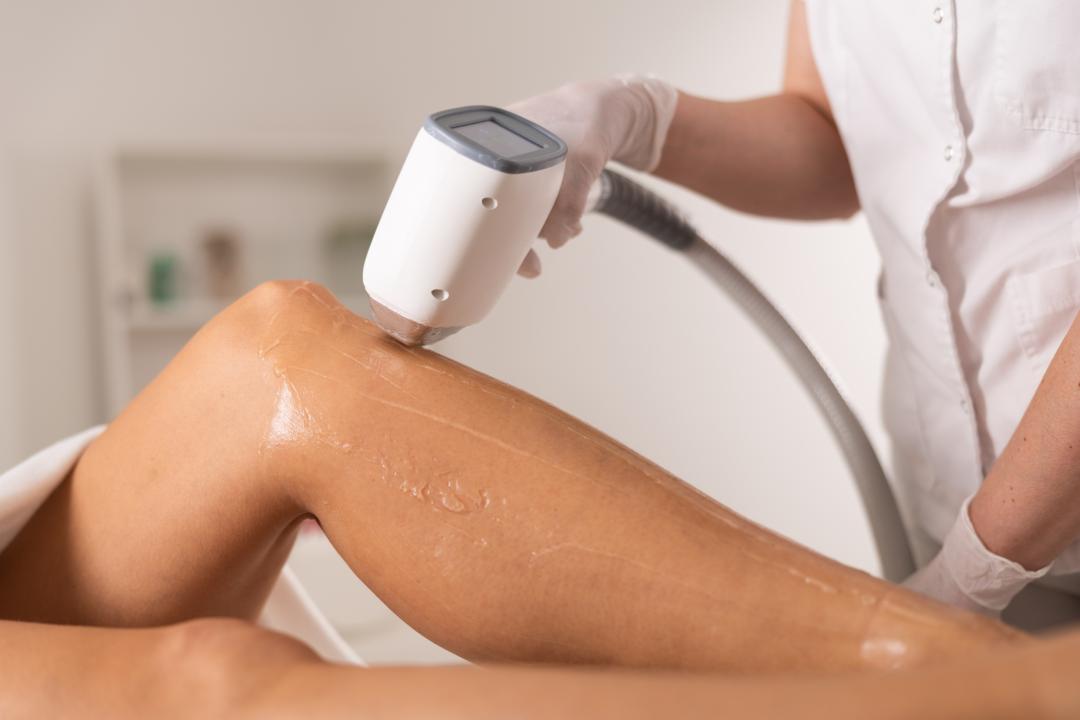 Pearl Beauty #novisad Laserska epilacija Laserska epilacija celih nogu - za dame