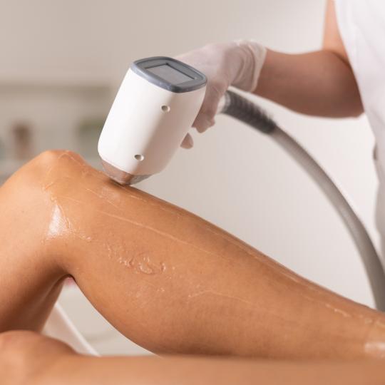 Pearl Beauty #novisad Laserska epilacija Laserska epilacija celih nogu - za dame Laserska epilacija 