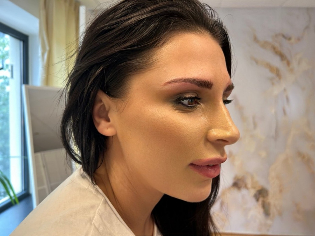 Esthetique Privé #beograd Trajna šminka Trajna šminka obrva - PHI BROWS MICROBLADING