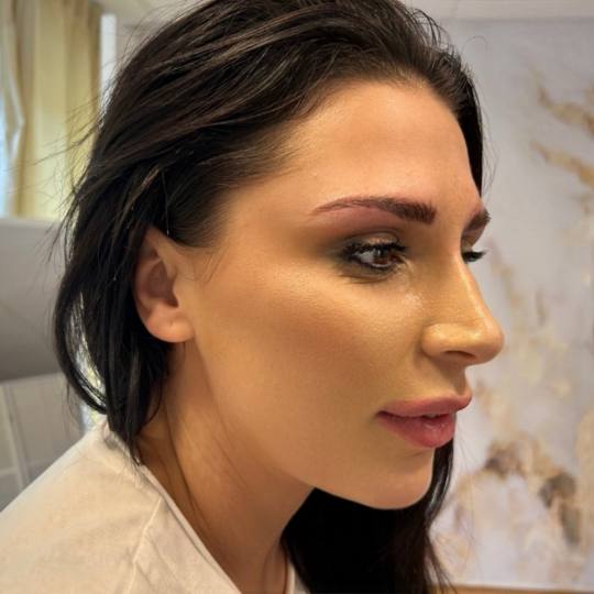 Esthetique Privé #beograd Trajna šminka Trajna šminka obrva - PHI BROWS MICROBLADING