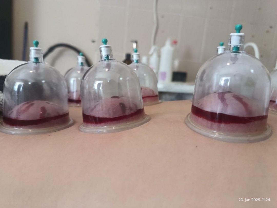 Relax body centar #zajecar Masaža teglama Mokra hidžama