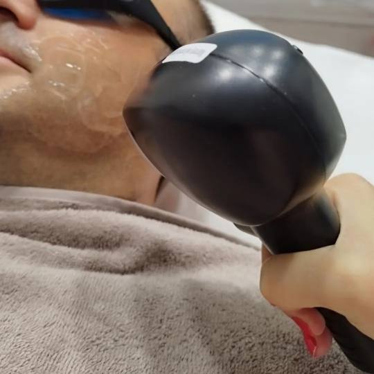 Kokilie Beauty Studio #novisad Laserska epilacija Laserska epilacija linije brade - za muškarce Naj