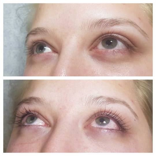 Beautyland #nis minival trepavica