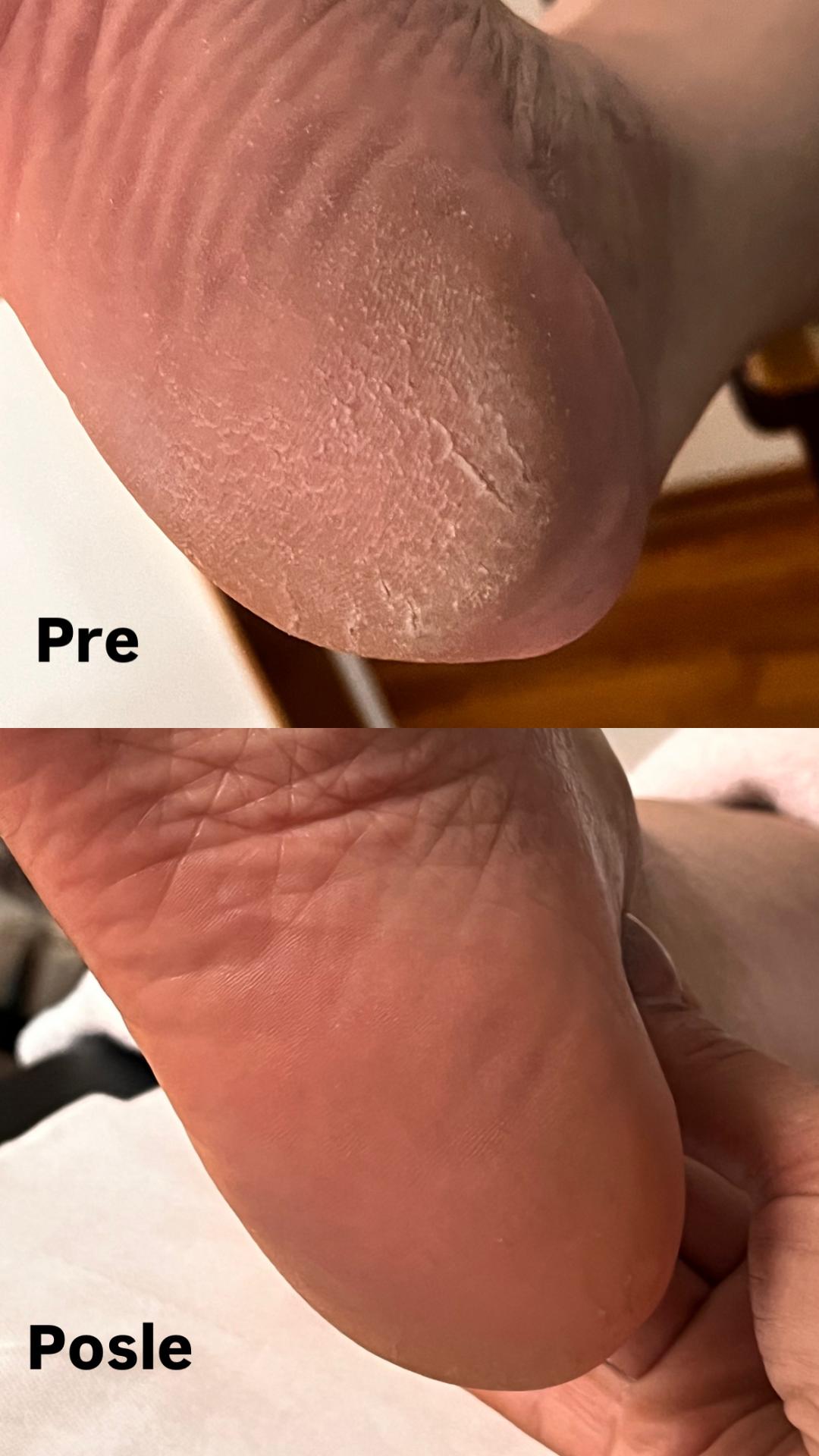 Belle Ana #beograd Estetski pedikir Ruski pedikir