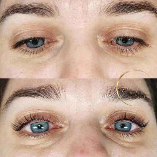 AM BEAUTY STUDIO #odzaci Trepavice Lash lift (uključuje farbanje trepavica)