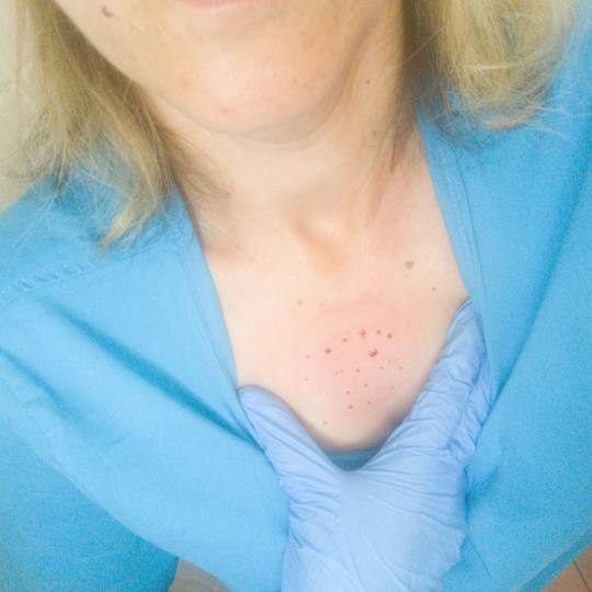 Relax body centar #zajecar Masaža teglama Mokra hidžama