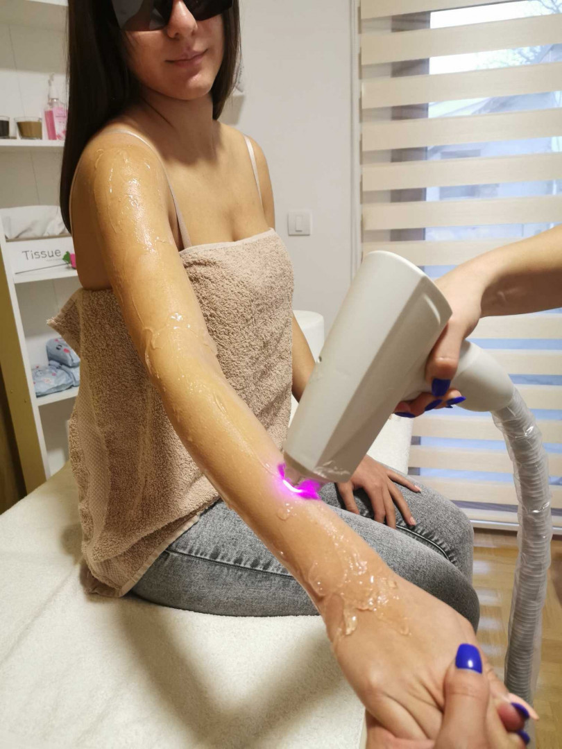 D&D Beauty Center #beograd Laserska epilacija Laserska epilacija celih ruku + pazuha - za dame