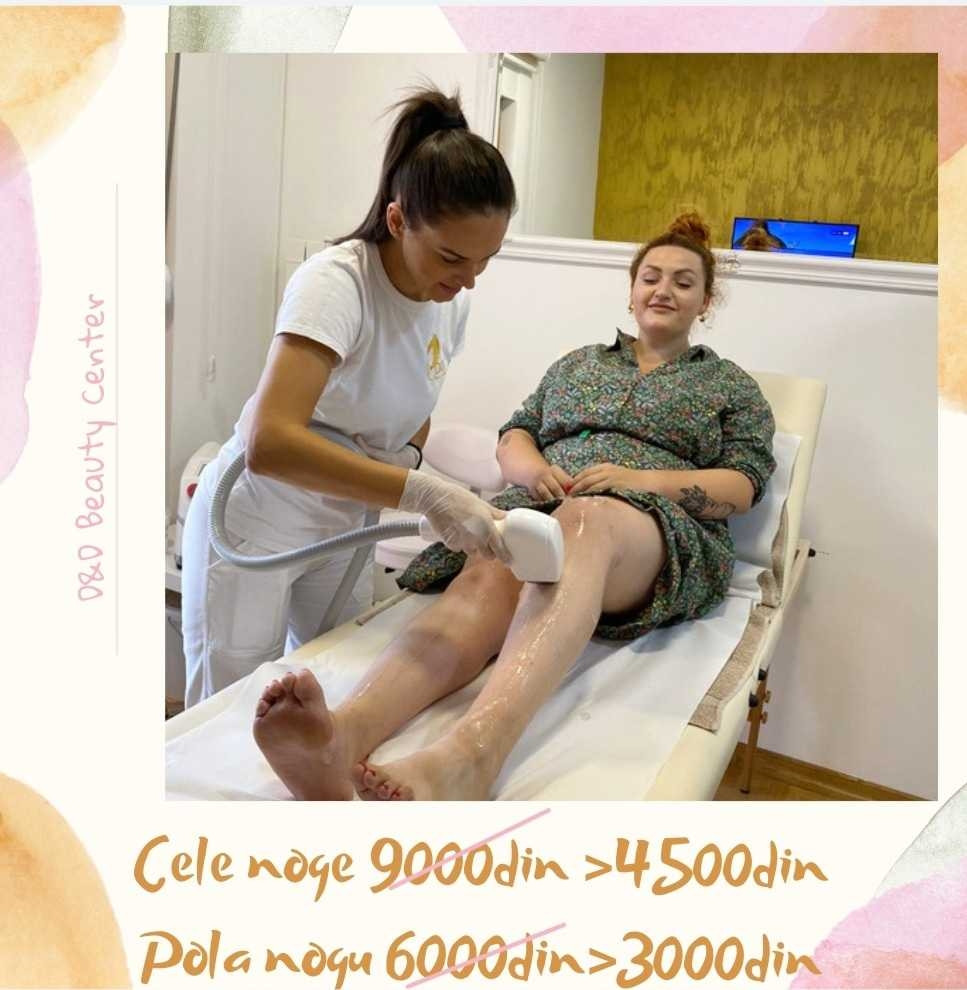 D&D Beauty Center #beograd Laserska epilacija Laserska epilacija celih nogu - za dame