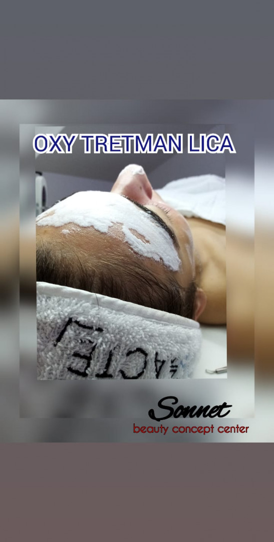 Sonnet beauty concept center #beograd Tretman lica OXY tretman lica