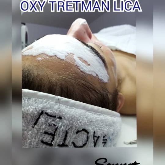 Sonnet beauty concept center #beograd Tretman lica OXY tretman lica