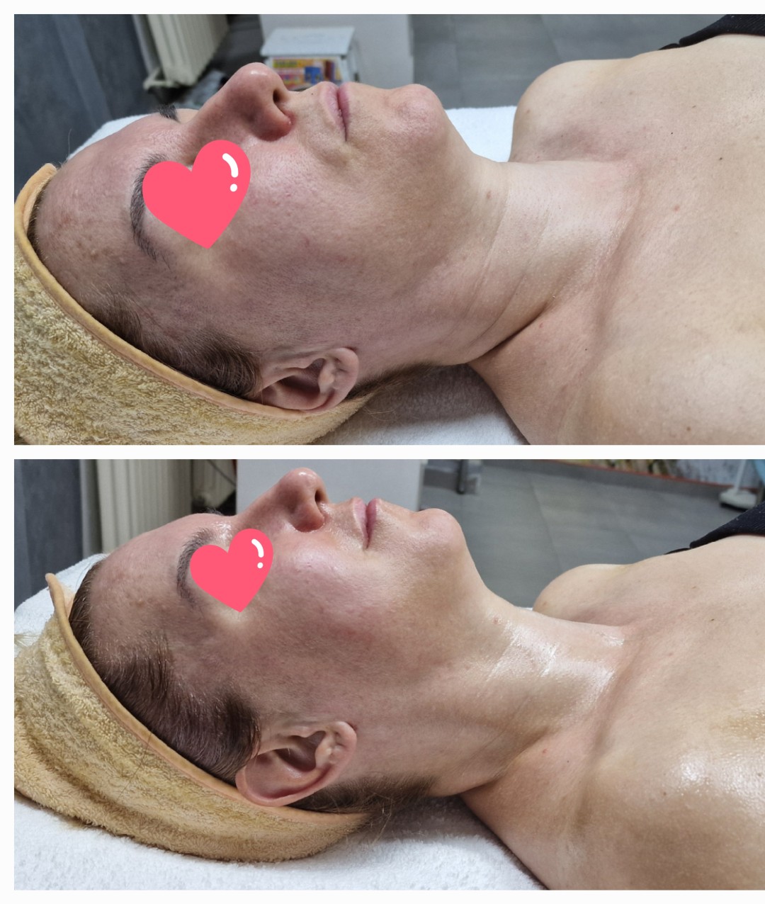 Fit limfomodelovanje lica - Seaside beauty, Beograd Opšta masaža Masaža Opšta masaža, Beograd, Novi Beograd Fontana, Tošin bunar