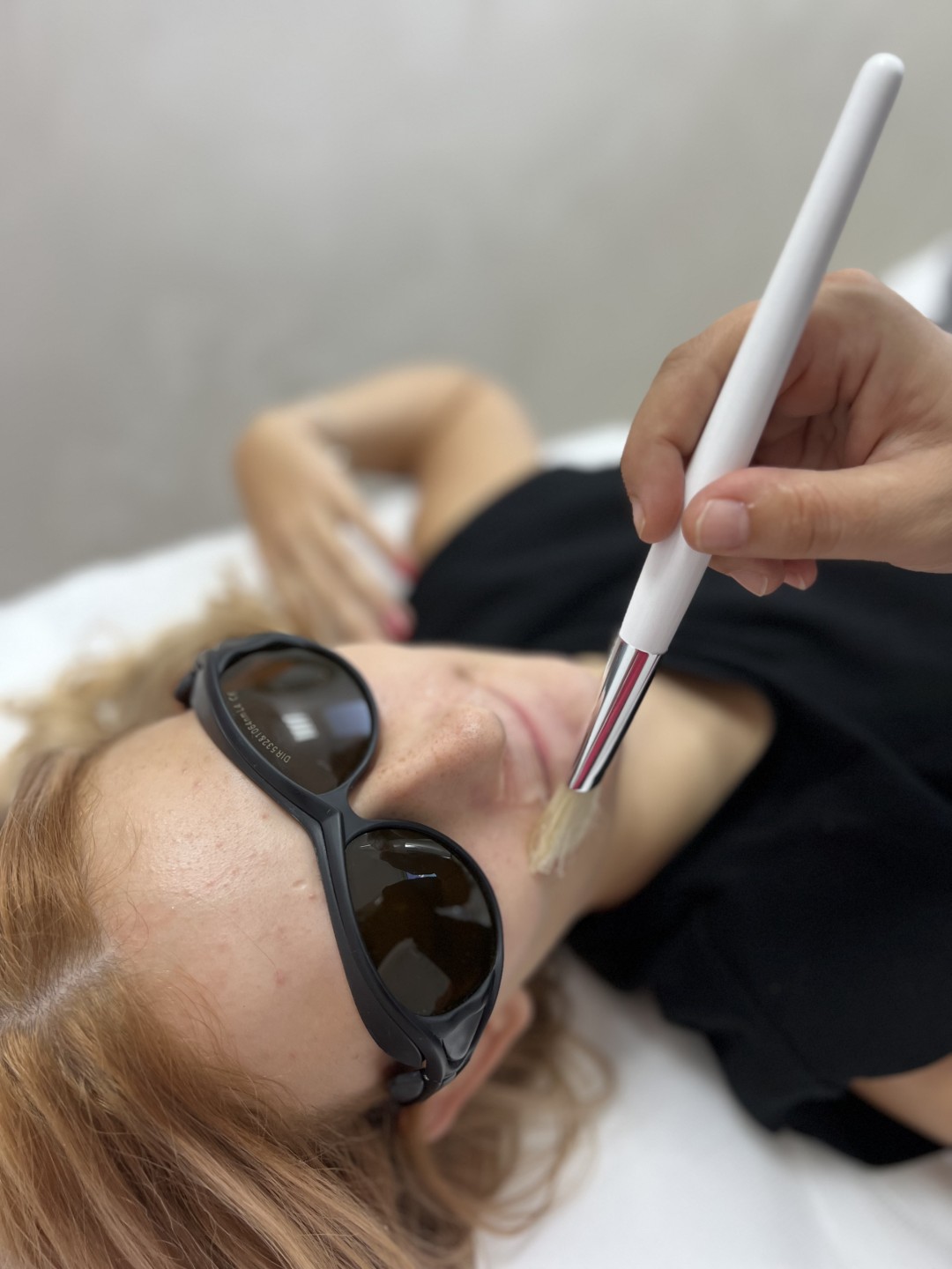 GM Beauty studio #beograd Laserska epilacija Laserska epilacija nausnica - za dame