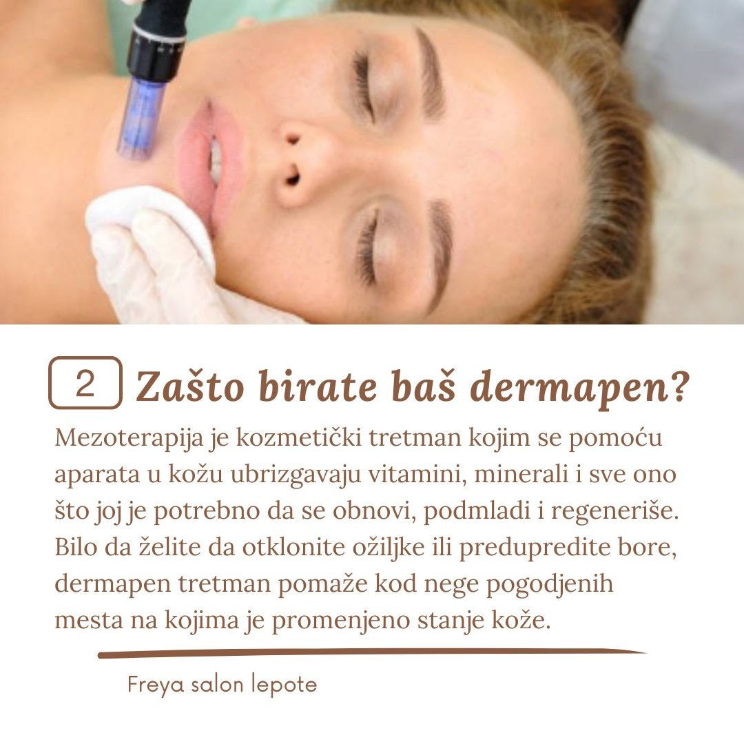 Mezoterapija dermapenom protiv ožiljaka od akni,- lice - Freya 1, Beograd Tretman lica Lice Tretman lica, Beograd, Centar, Stari grad, Dorćol