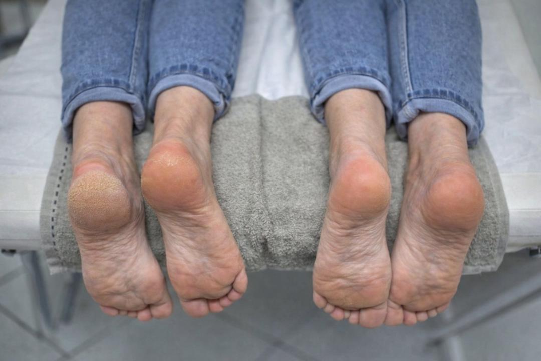 Shishi beauty studio #beograd Estetski pedikir Disk pedikir - pete