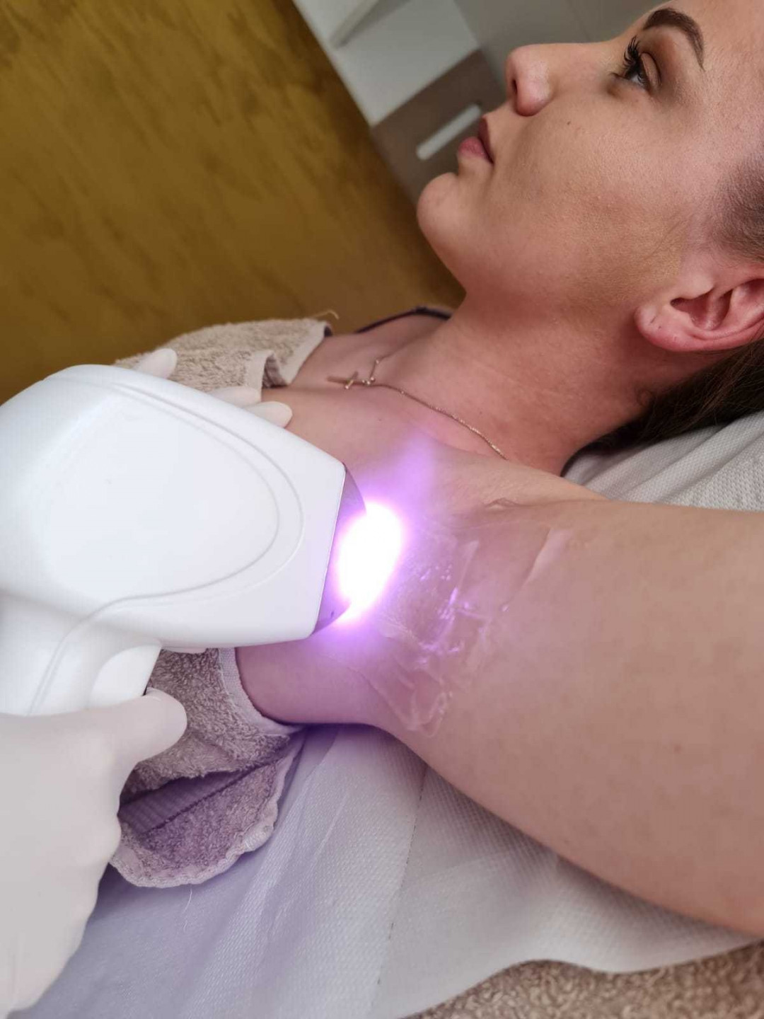 D&D Beauty Center #beograd Laserska epilacija Laserska epilacija pazuha - za dame