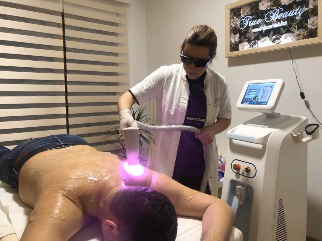 D&D Beauty Center #beograd Laserska epilacija Laserska epilacija leđa - za muškarce