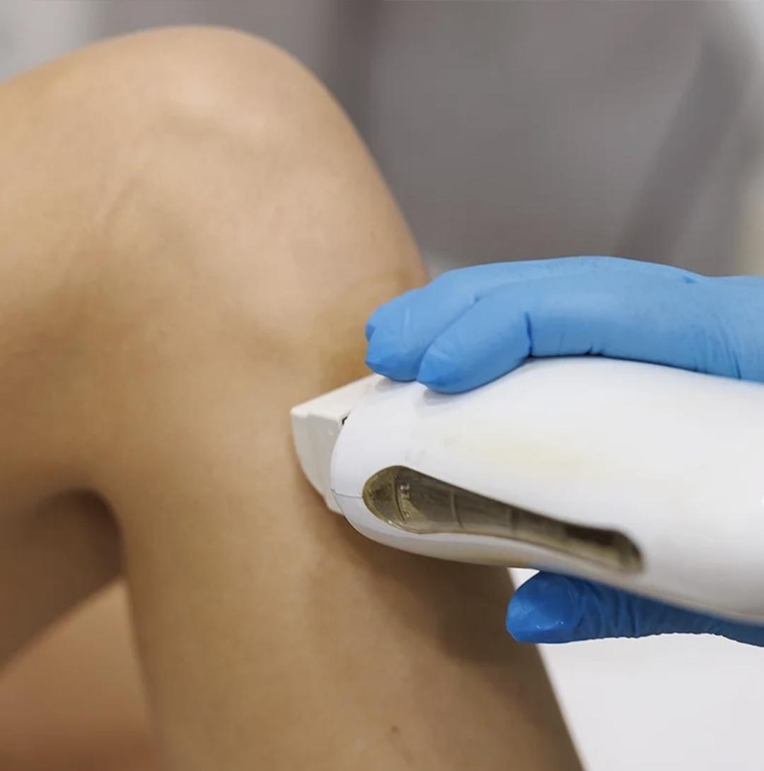 In line 2 #pancevo Depilacija nogu Depilacija celih nogu hladnim voskom - za dame