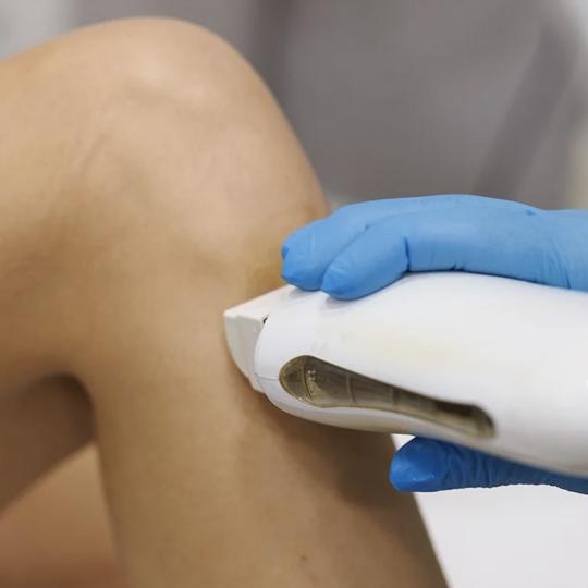 In line 2 #pancevo Depilacija nogu Depilacija celih nogu hladnim voskom - za dame