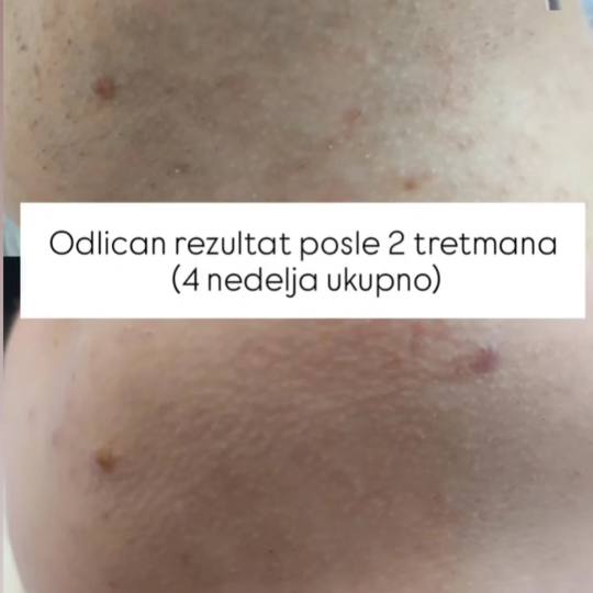 LYS by Royal Beauty Switzerland usluga