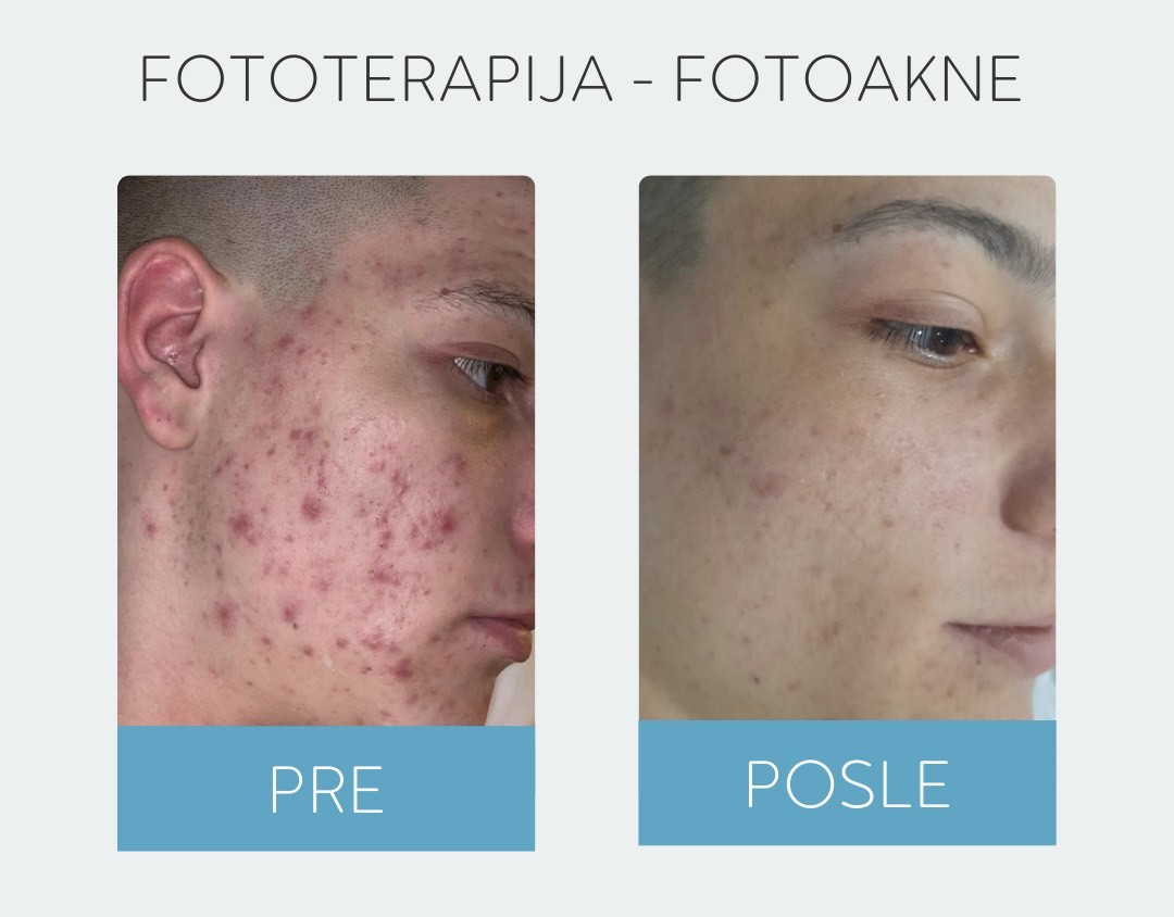 DepilConcept #beograd