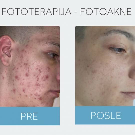 DepilConcept #beograd