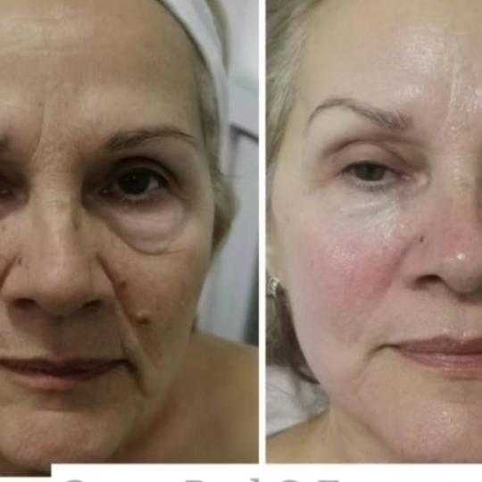 Choco Love #beograd Tretman lica Green peel - Energy Green peel Energy- Osvezavajuci biljni tretman 