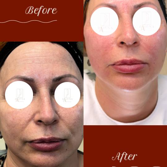 DajanaAesthetics usluga