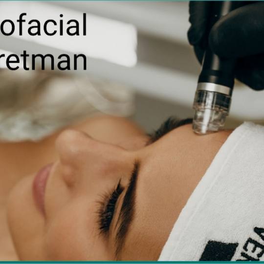 Laser centar Delight #beograd Piling lica Hydrafacial tretman lica