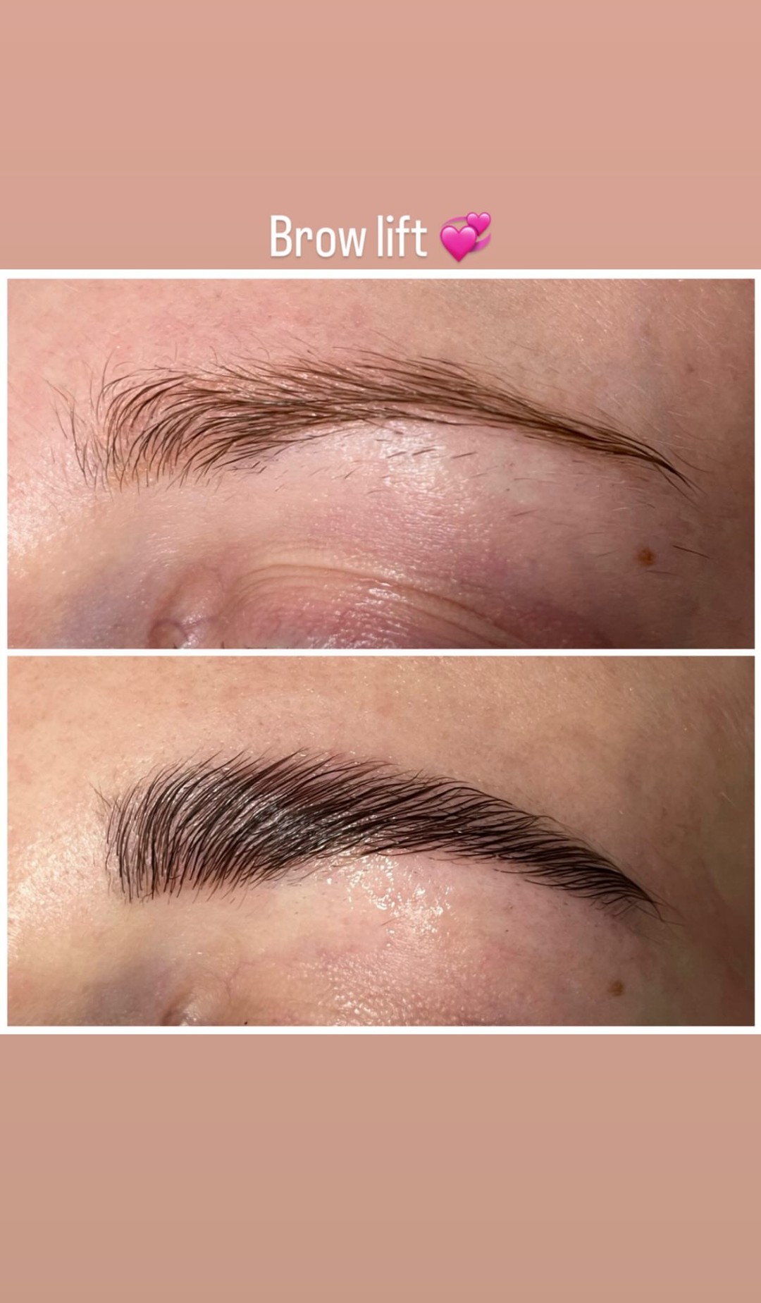 Mo-star-s 5 #beograd Obrve Brow lift