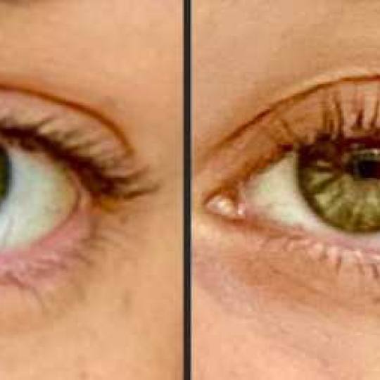 Baby's life A&A #beograd Trepavice Lash lift - lifting trepavica raščešljavanje trepavica