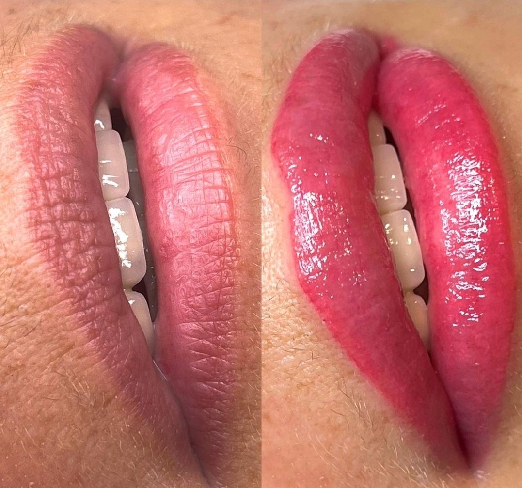 Esthetique Privé #beograd Trajna šminka Trajna šminka usana - PHILIPPS