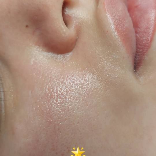 LYS by Royal Beauty Switzerland usluga